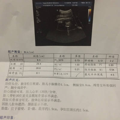 34周了去产检做B超,医生说宝宝偏小,腿短,这个