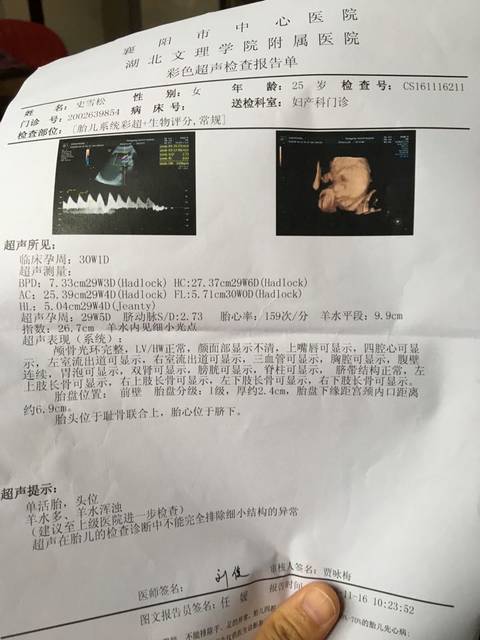 急急急!孕30周羊水多还浑浊怎么办_孕30周检查羊水过多羊水_宝宝树