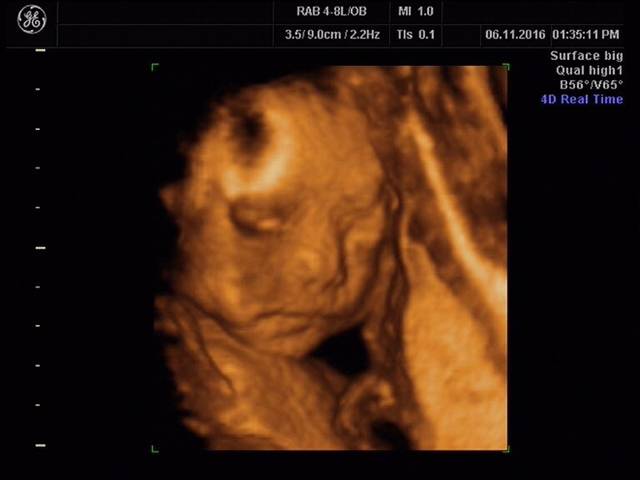 俺家可爱的宝宝四维图片_给宝宝做四维的时候,小家伙非常听话,_宝宝树