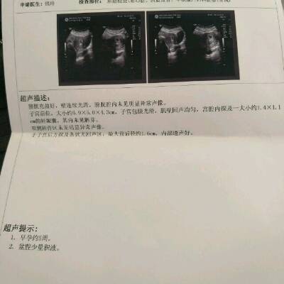 我刚查出怀孕,约5周,还没发现胚芽心跳这些,在