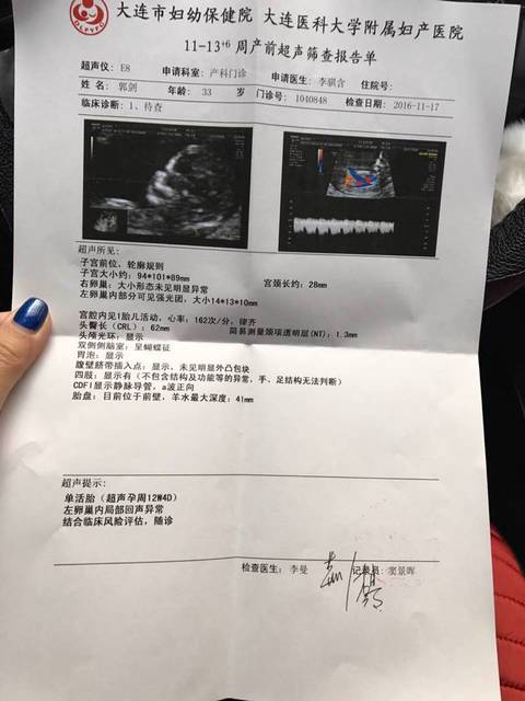 nt图能看到小孩五官吗?_NT照片,图1里是眼睛鼻子嘴吗?不_宝宝树