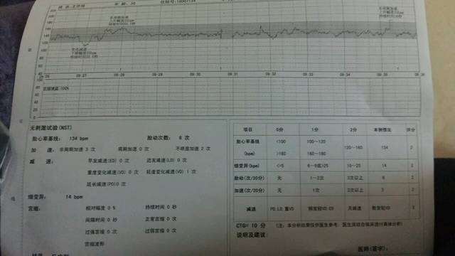 胎心监护单看男女_宝妈们怎么从胎心监护单看