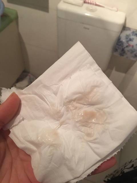 白带有粉红色分泌物什么情况_怀孕初期白带里