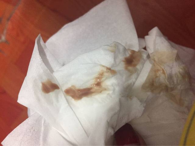 _我今天抽血检查怀孕了,才25天,昨天就开始有