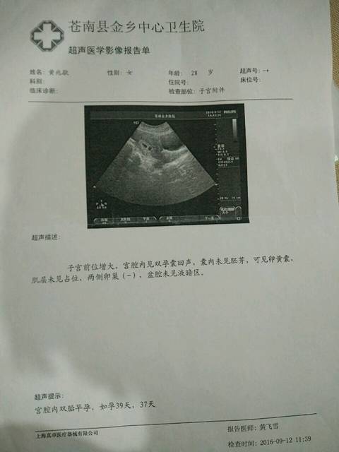 双孕囊是异卵还是同卵_双胞胎第一次检查双孕