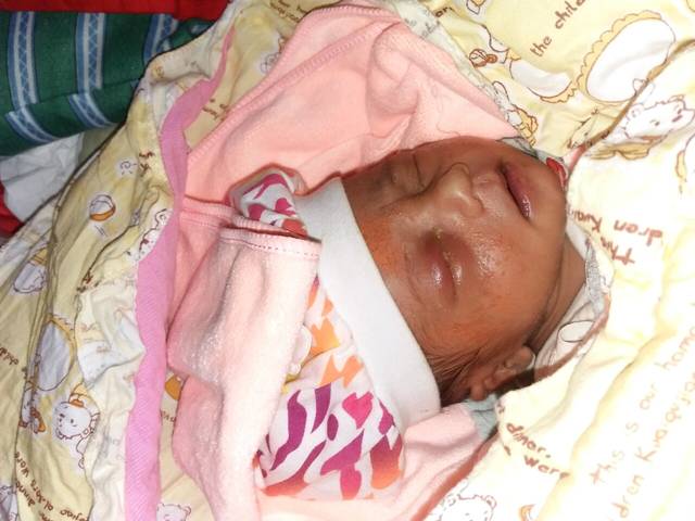 急急,_我家宝宝眼睛肿起来,还时不时出黄色眼