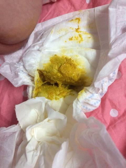 宝宝一个月七天了,这几天拉屎特别稀。带图