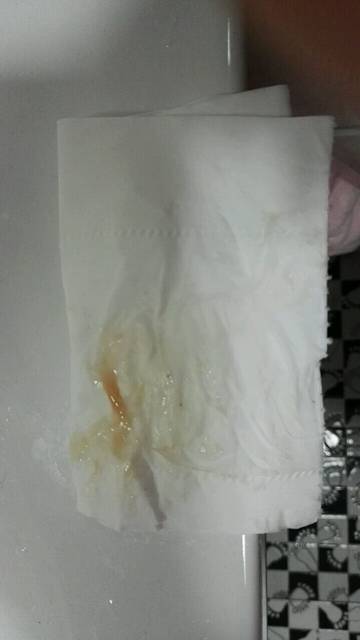 产前见红颜色辨别,请有经验宝妈帮忙看看,谢谢!