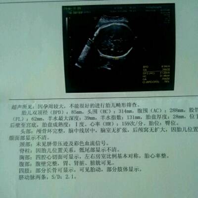 怀孕34周,今天才做的彩超,大家帮忙看看,二胎,大宝是男孩,之前做检查