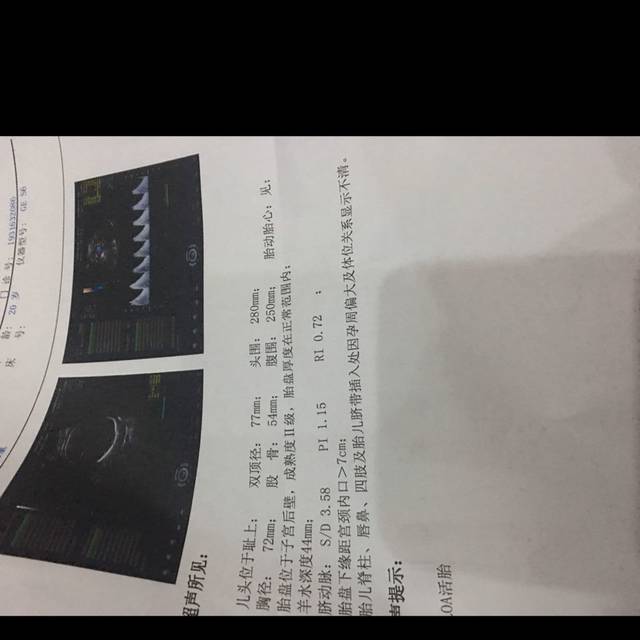 现在怀孕7个月了又谁会算宝宝体重多少