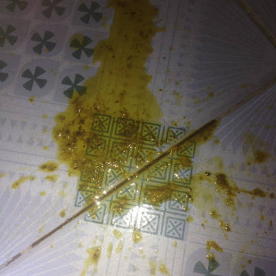 宝宝快3个月了,吃纯母乳喂养,两个多月宝宝大