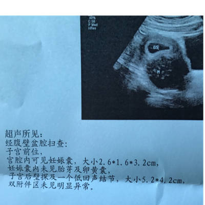 怀孕六周,昨天b超没有看到卵黄囊及胎心胎芽,