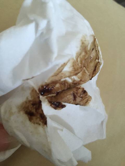 保胎药吃四天 怎么还有分泌物血丝流出_保胎药