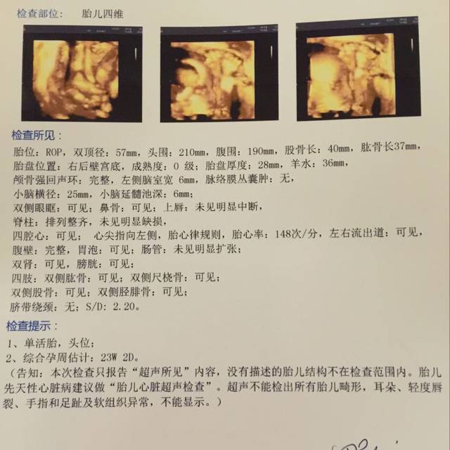 今天四维彩超做完了!_医生说宝宝手挡着脸了,
