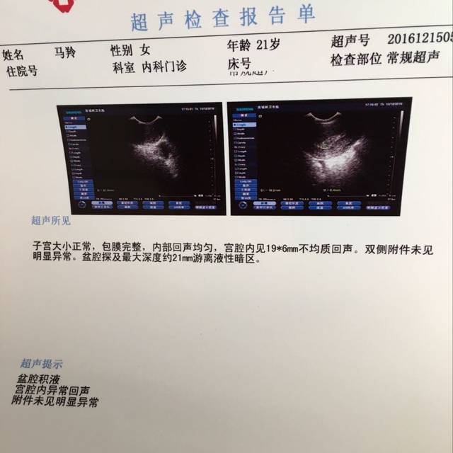 懂得宝妈帮忙看看!_药流不干净 只想知道残留