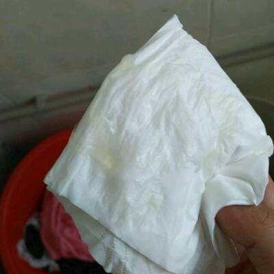 谁能告诉我这是不是羊水啊?