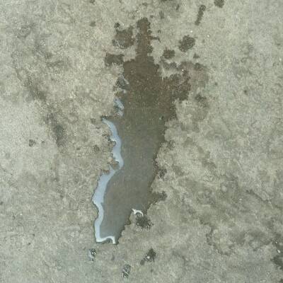 我家宝宝发烧打针后一直让多喝水,下午5点尿的尿是乳白色的,怎么回事?