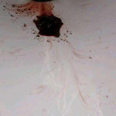 做试管婴儿怀孕6周+3日,30号下午突然出血马