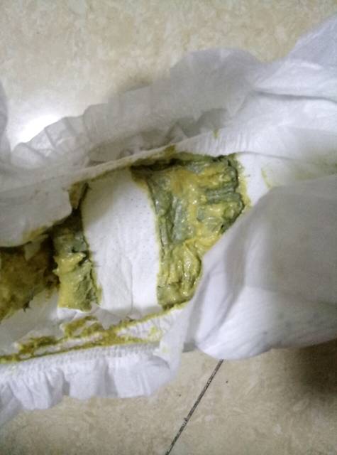 宝宝的便便黄绿色_我是混合喂养,一天喂4次奶