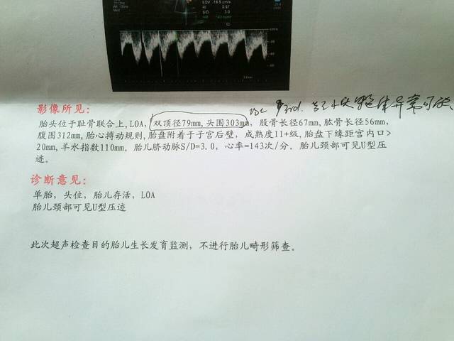 孕37周,医生说头小可能小头畸形_怀孕37周B超