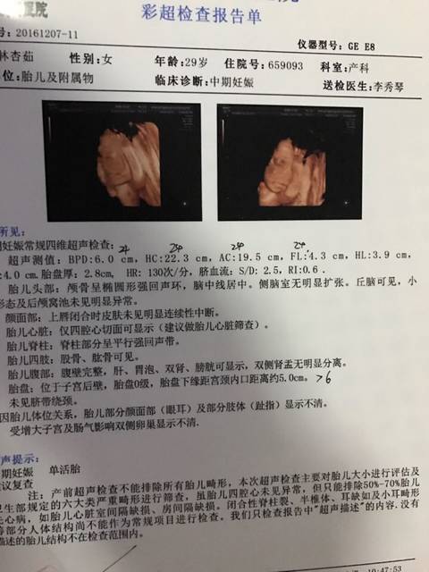 4维彩超能看出男女吗?_怀孕24周了 都说4维彩