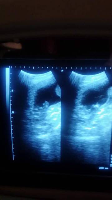 看的发单来_曾经在医院上过班,现在怀上二胎内退