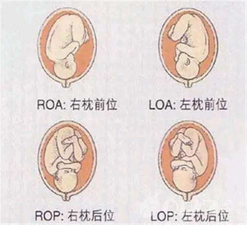 b超单上的胎位loa和roa什么意思?那种胎位比较好?