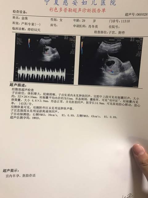 正能量45天啥都没有~56天胎心胎芽都有了!谁