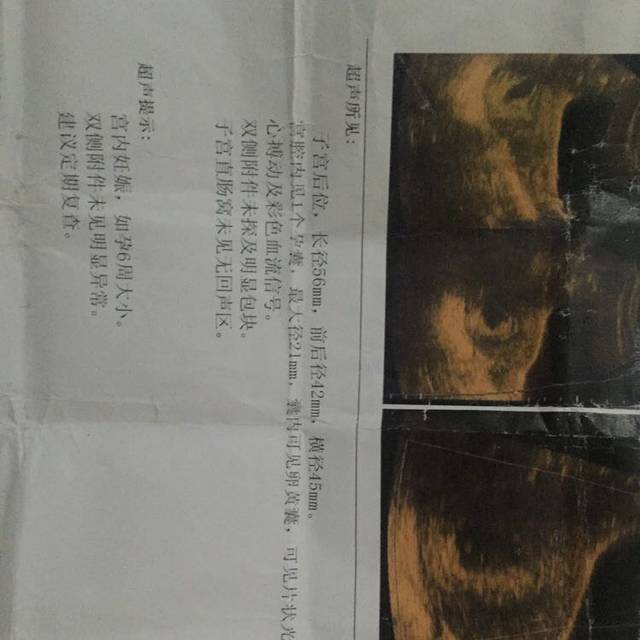 懂的帮我看看。这是胎停吗。给我点希望_2次