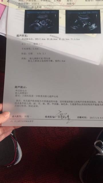 胎儿畸形排查,查出有唇裂怎么办?_今天去做大