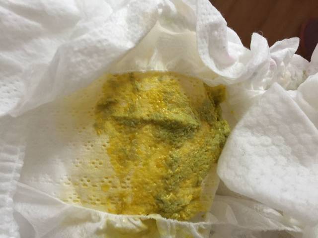 宝宝月大宝宝拉肚子,轮状两个_病毒现在56天,花生酱加芝麻酱好吃吗图片