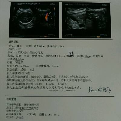 怀孕29周,胎儿双肾盂分离,B超显示胎儿腹部有