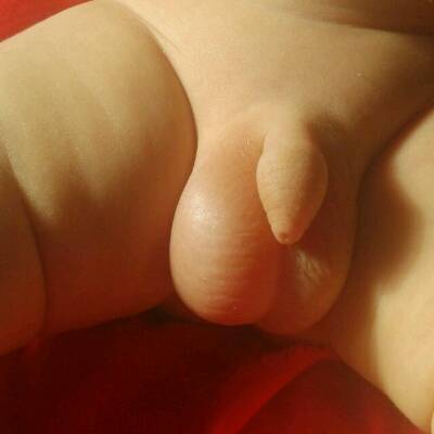 宝宝24天,偶尔会有右侧睾丸变大,好像里面有液