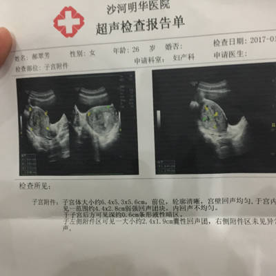 怀孕40天 见红 做B超 说看不见胎囊 宫腔内还有