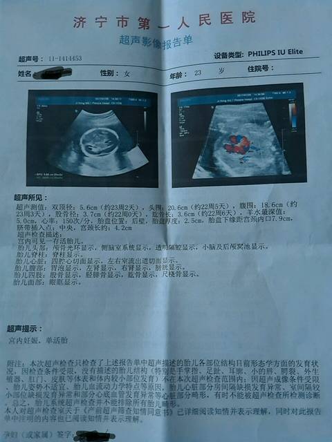 产检:二级筛查报告_怀孕22周+3天,做了二级筛