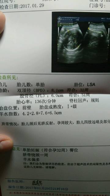 求解_谁会计算宝宝体重帮忙算算_宝宝树