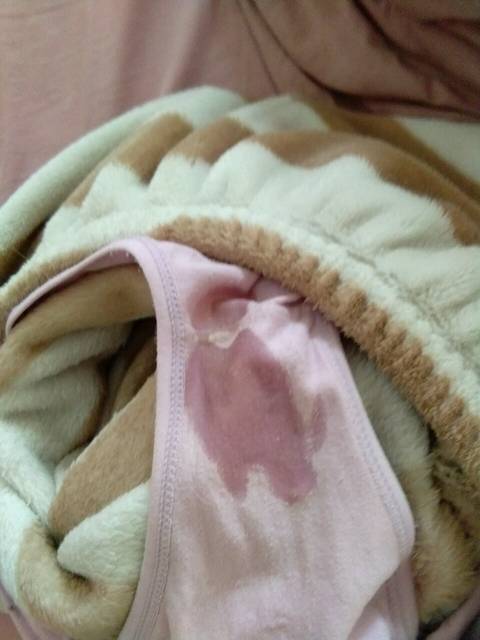 这是啥,内裤都湿了,没事吧_帮看看有事没,白色的,好多_宝宝树