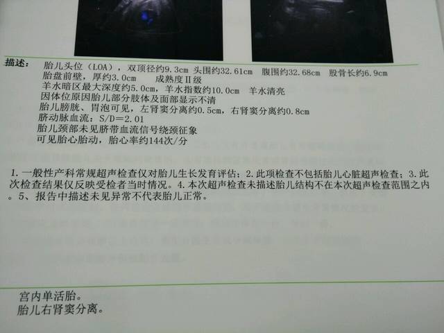 四次彩超检查都有双肾窦分离,我很担心_我想问