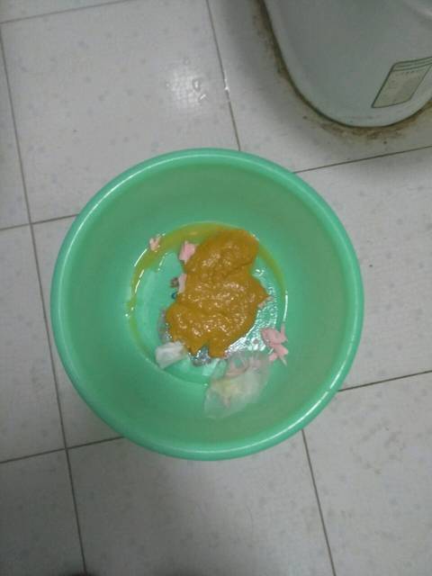 宝宝七天没拉屎,终于不淡定了!