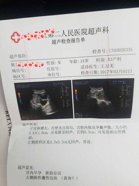 看孕囊判断胎儿性别_孕7周3,第一次做B超,胎心