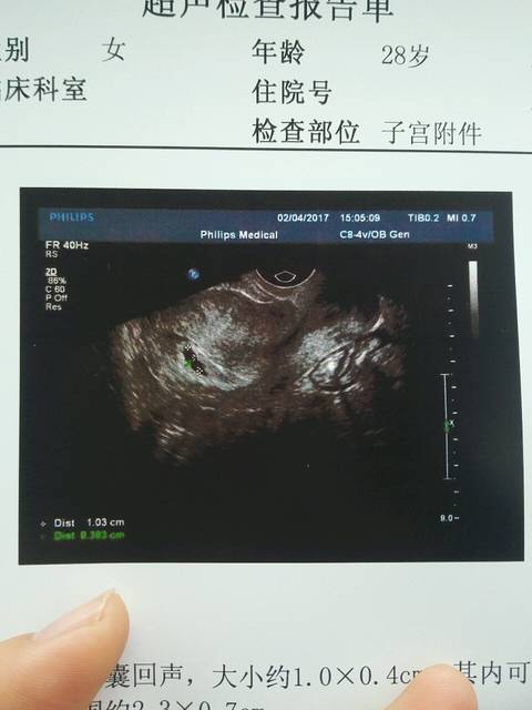 孕酮低,有出血_刚发现怀孕,有流血现象,目前流