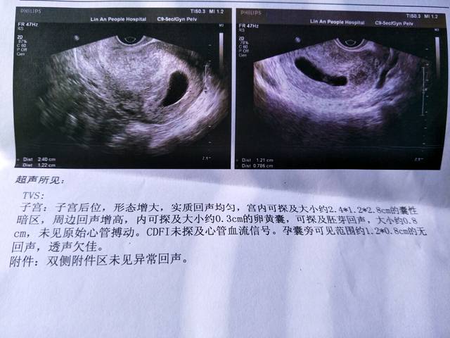 按末次月经算9周了,只有胚芽没有胎心怎么办?