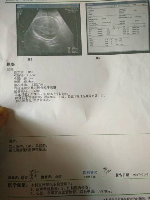 答:蛋清,正常白色呈透明的你好糊状或白带样,没有腥臭味,量少,这称之调理合成牛排图片