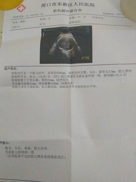 只有双顶径和股骨怎么算宝宝体重啊!π_π_今