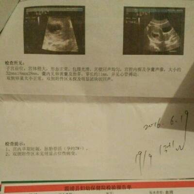 孕囊数值可以看男女吗,帮忙看一下