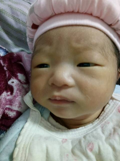 唐氏筛查21三体综合征高风险生下了会是唐氏