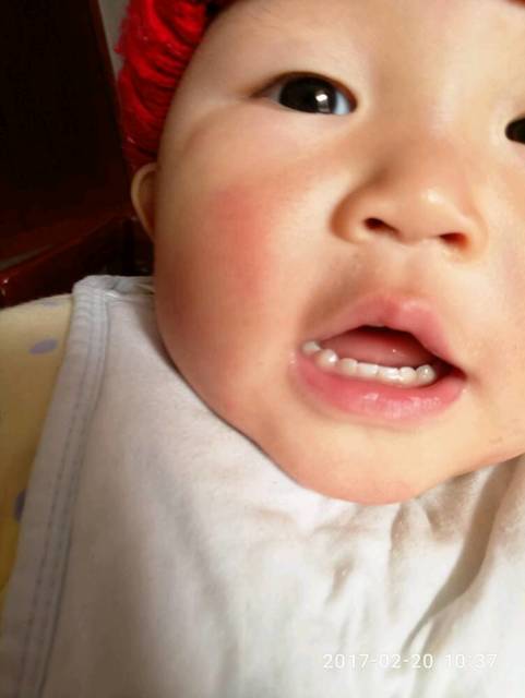 宝宝一岁二都出了多少牙齿呢?_宝宝五个月出