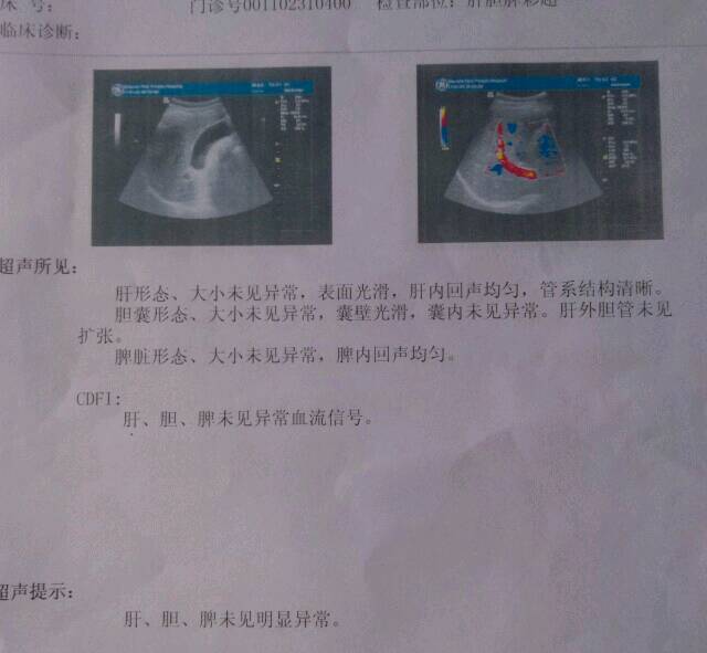 怀孕后有肝右叶囊肿对胎儿有影响吗?_请问宝