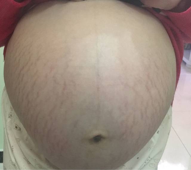 2月17日顺产8斤男宝_怀孕初期,孕吐时间短,一