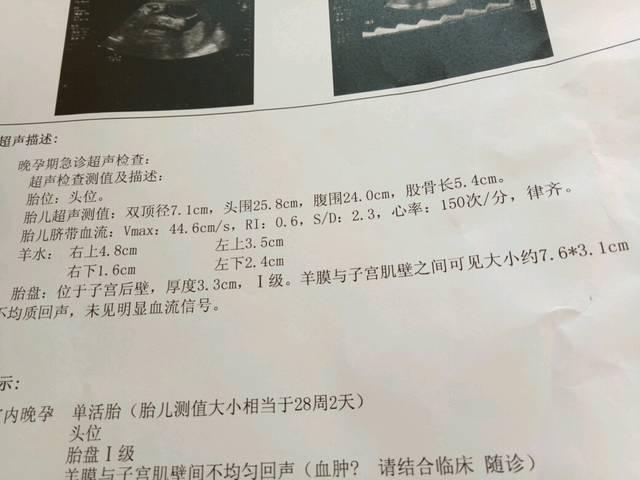 检查羊膜与子宫肌壁间有不均质回声_孕27周出